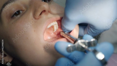 A dentist applies an injection of anesthetic before removing a tooth to a patient in a dental clinic. Dental treatment concept. Medicine concept