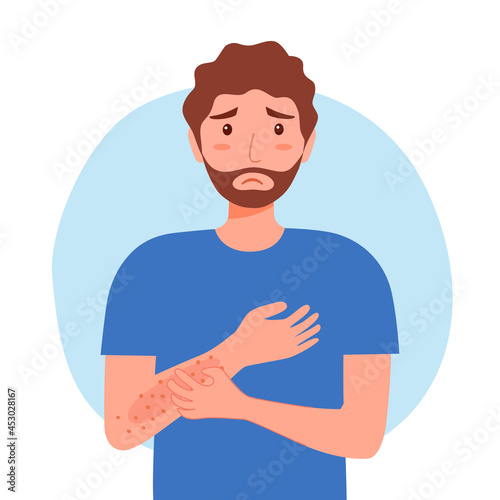 Young man scratching arm. Guy suffering from strong allergy skin itchy symptom in flat design. Red rash skin irritation.