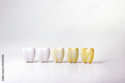 Discoloration healthy teeth from whitening teeth to yellow teeth, When is your oral health bad The tooth surface will begin to decay. The yellow dentin will appear