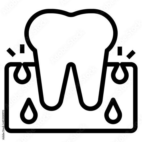 abscess gums