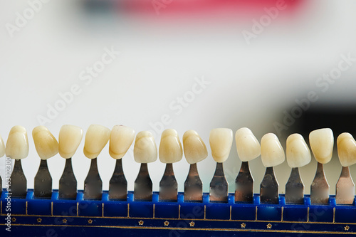 Various dental model samples in hospital