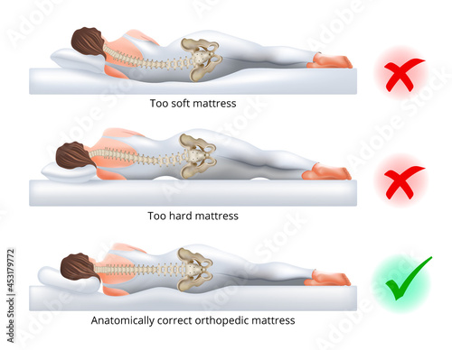 Choosing an orthopedic mattress for sleeping - Correct and incorrect sleeping position on the side, vector illustration.
