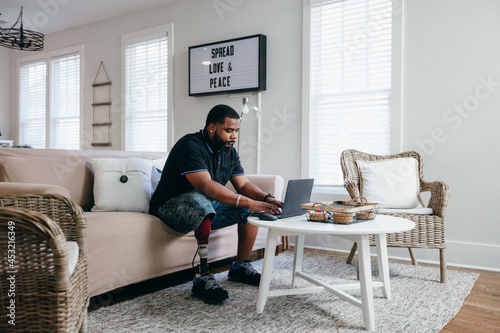 Black man with prosthetic leg working from home on laptop photo