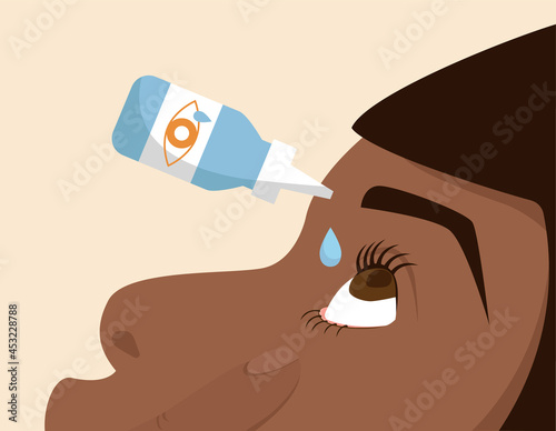 Person applying eyedrops. Medical treatment, pharmacy, irritaion. Can be used for topics like allergy, glaucoma, opthalmology or inflammation