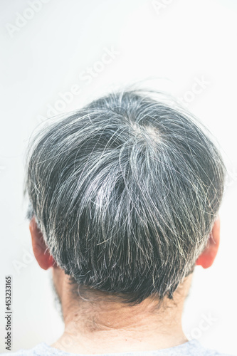 Wallpaper Mural Gray hair problems in men. Hair Dye Product Concept. Torontodigital.ca