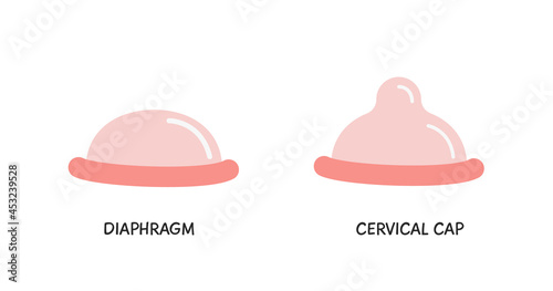 Contraceptive diaphragm and cervical cap colored flat style icons. Birth control methods. Safe sex vector elements. Contraception items photo