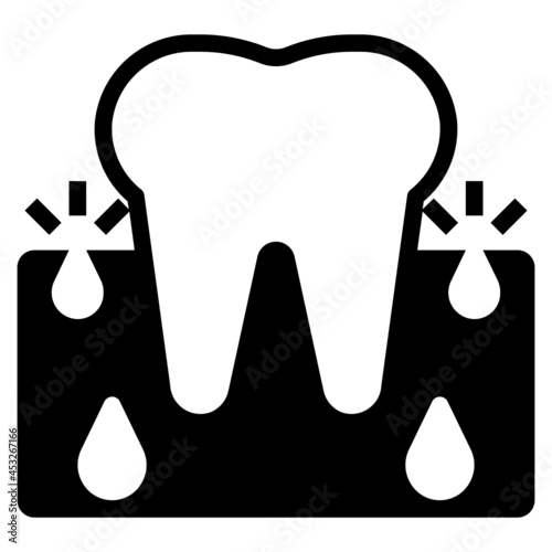 abscess gums