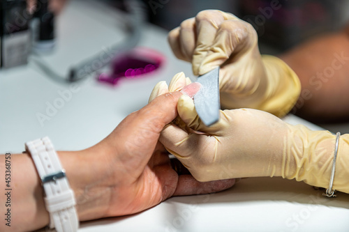 nail reconstruction with monophasic gel photo