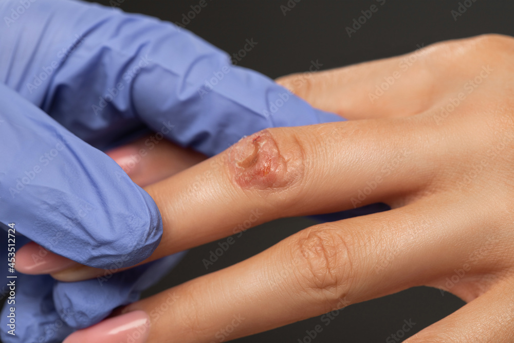 The doctor makes an examination of the wound on the woman's finger. The doctor makes an examination of the wound on the woman's finger.