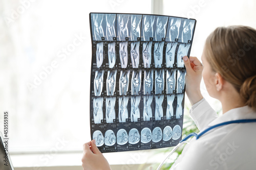 Female doctor with x-ray image in clinic