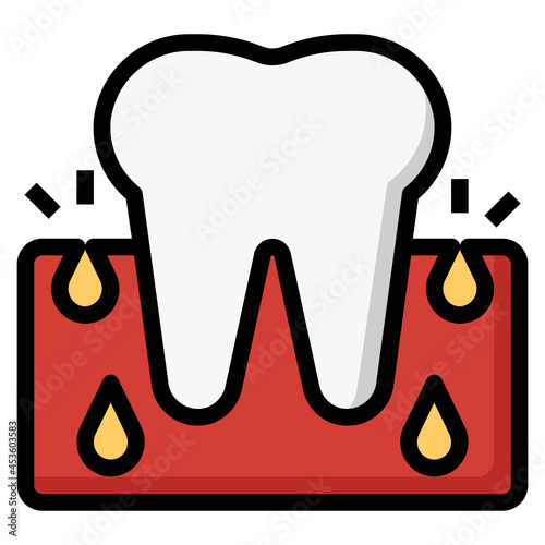 abscess