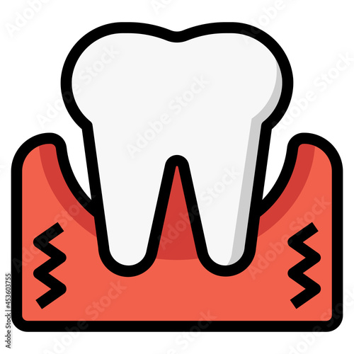 gingival