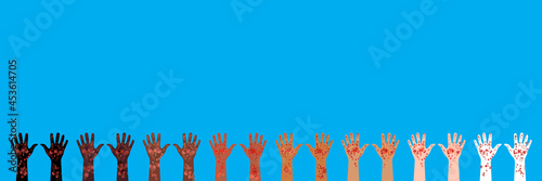Horizontal banner. 8 pairs of hands raised up. Hands of different races and skin colors. Palms up. Painful rash covers skin. Vector illustration of skin diseases and manifestations of illness signs.