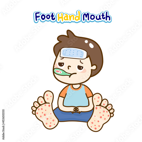 Hand Foot and Mouth Disease 		
