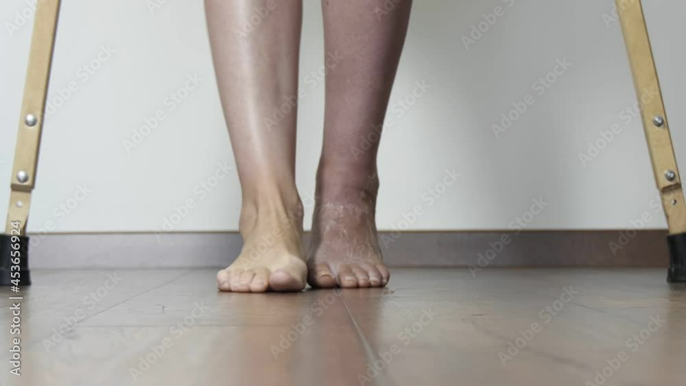 A woman after a broken leg to learn to walk. Rehabilitation after removal of plaster bandage. A woman walks on crutches. A woman after a broken leg to learn to walk. Rehabilitation after removal of plaster bandage. A woman walks on crutches.