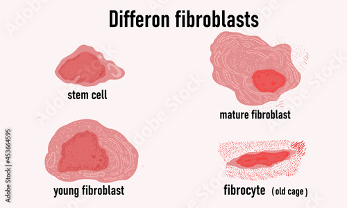 Diffcron of fibroblasts, cell growth. Stem cell and young fibroblast. Mature fibroblast and fibrocyte, old cell. Skin, face rejuvenation.Medicine and cosmetology.Vector illustrator. photo