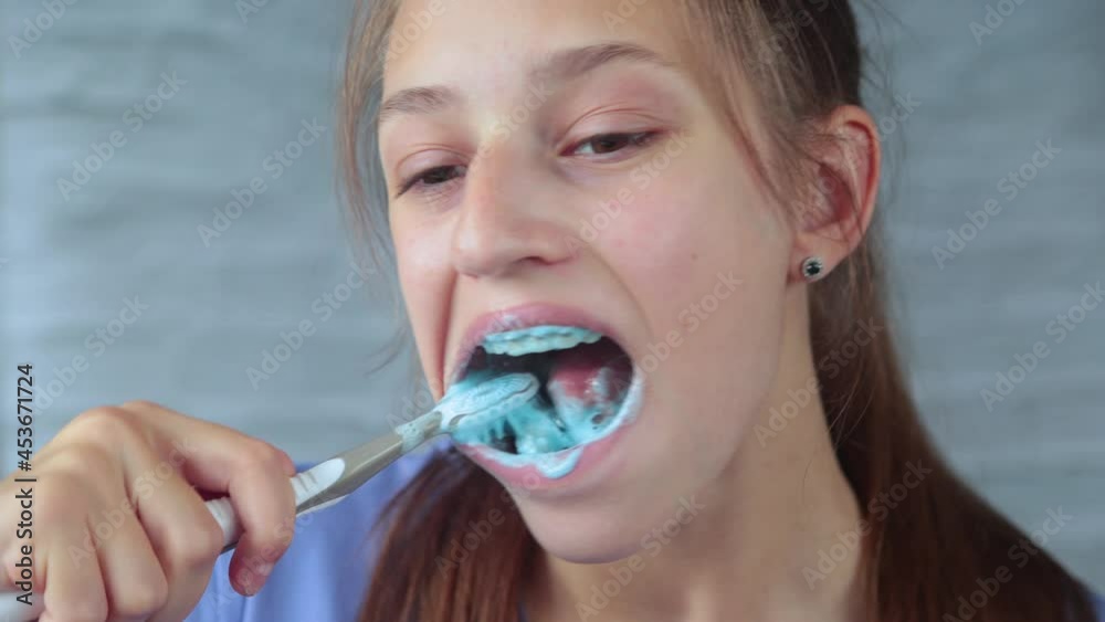 Girl with braces cleaning teeth Stock Video Adobe Stock