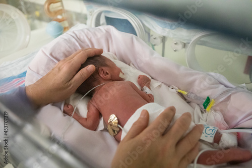 Premature newborn baby in incubator photo