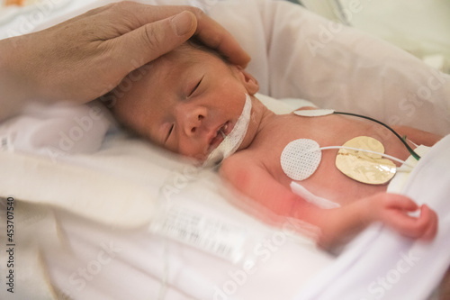 Premature newborn baby in incubator