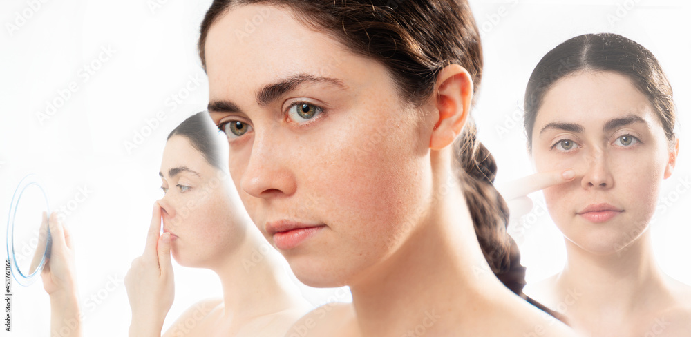 Aesthetic cosmetology. Three faces of young caucasian woman comparing results before and after plastic nose surgery. Isolated on white background. Concept of rhinoplasty Aesthetic cosmetology. Three faces of young caucasian woman comparing results before and after plastic nose surgery. Isolated on white background. Concept of rhinoplasty