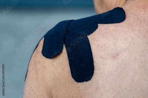 Physiotherapy concept, Close up back of a man with black muscle tape supporting shoulder, The acromion is a bony process on the scapula (shoulder blade) Health care and medical, Human anatomy. photo