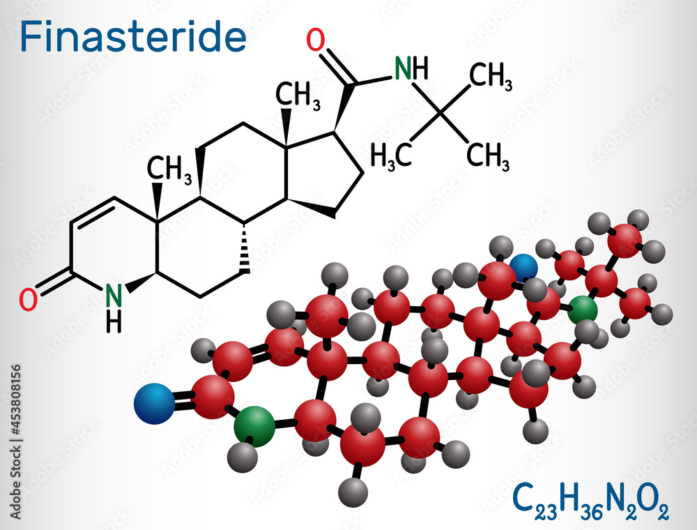 Finasteride molecule. It is used to treat symptoms of benign prostatic hypertrophy and male pattern baldness. Structural chemical formula and molecule model