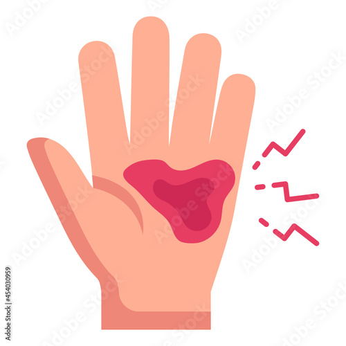 Hand Fracture

