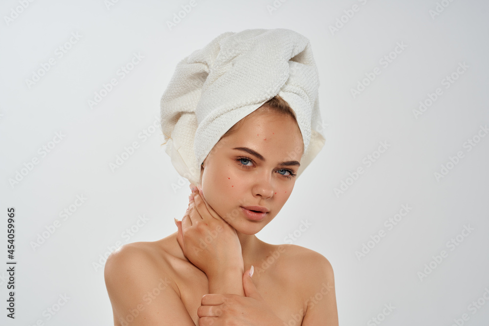 pretty woman with a towel on my head facial skin problems pimple pretty woman with a towel on my head facial skin problems pimple