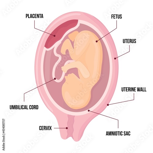 Vector infographic with fetus of womb and placenta. anatomy diagram illustration with umbilical cord and cervix.