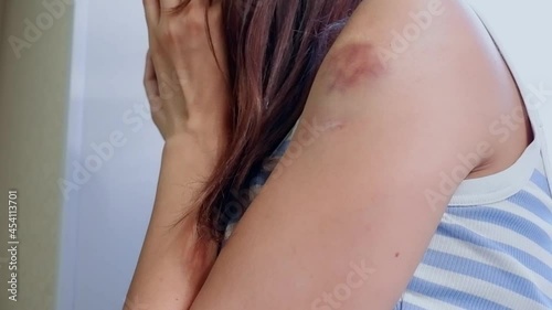 Wallpaper Mural A woman in a white-blue T-shirt with a bruise on her arm after the beatings is crying in pain, covering her face with her hands while sitting on the window close-up. Domestic Violence. Torontodigital.ca