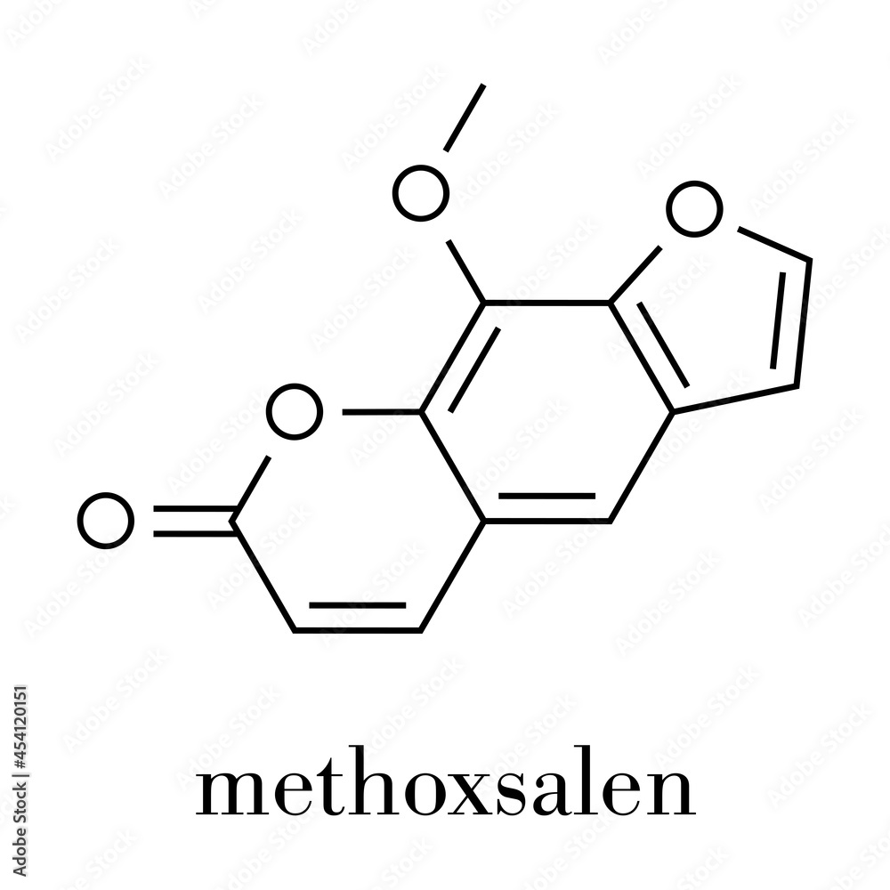 Methoxsalen (psoralen) skin disease drug molecule. Used in PUVA therapy in combination with UVA radiation. Skeletal formula. Methoxsalen (psoralen) skin disease drug molecule. Used in PUVA therapy in combination with UVA radiation. Skeletal formula.