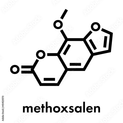 Methoxsalen (psoralen) skin disease drug molecule. Used in PUVA therapy in combination with UVA radiation. Skeletal formula.
