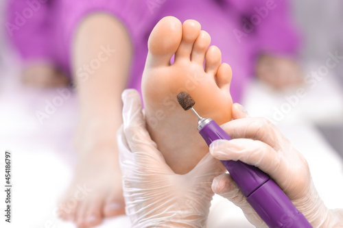 Pedicure. Peeling feet pedicure procedure from callus on foot by hands of podiatrist in white gloves