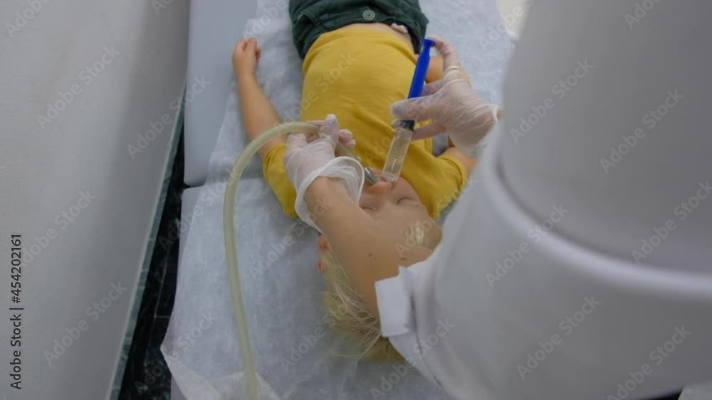 Nasal lavage method of transferring fluid. Washing the baby's nose in