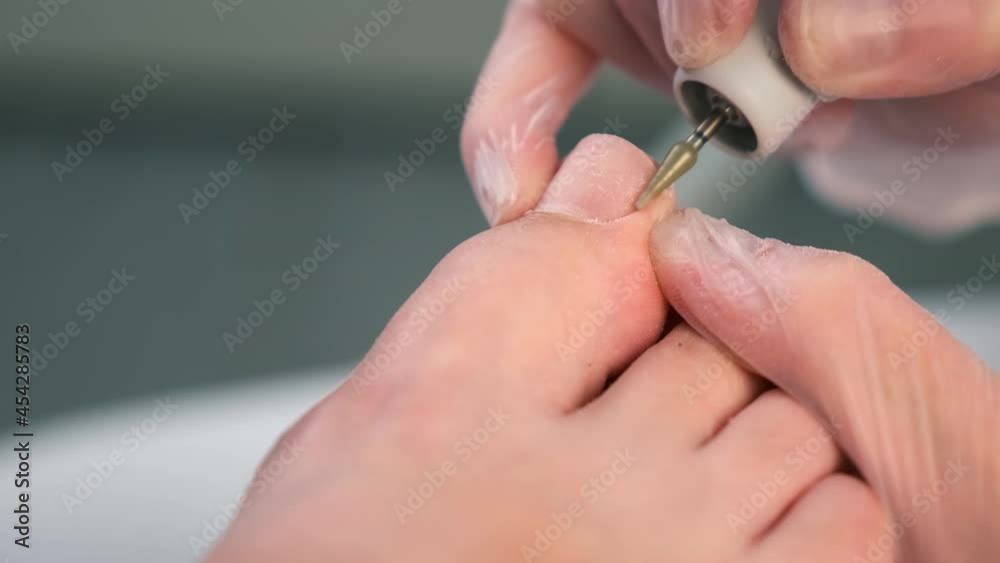 Pedicurist is making hardware pedicure using electric machine in beauty salon, closeup view. She treats the skin in the cuticle area on toes of woman in cosmetology clinic. Removes dry skin from toes. Pedicurist is making hardware pedicure using electric machine in beauty salon, closeup view. She treats the skin in the cuticle area on toes of woman in cosmetology clinic. Removes dry skin from toes.
