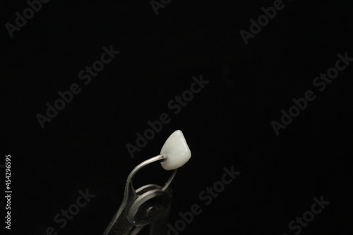 Checking the thickness of dental veneers.