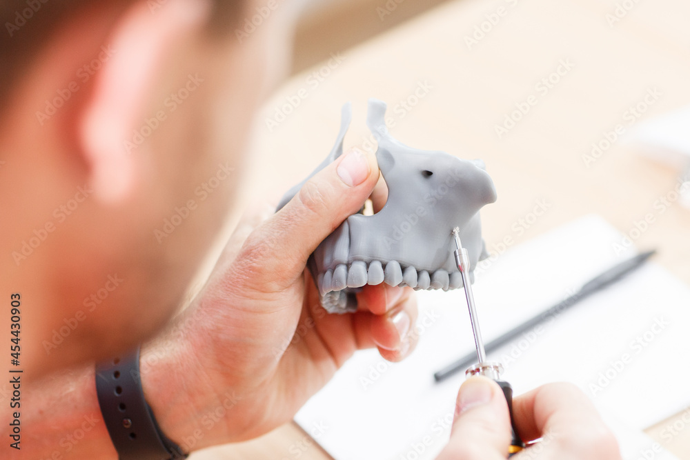 Dentist practice with mini screw model on dental model. Orthodontic dentistry. False teeth