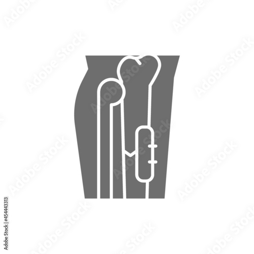 X-ray of broken leg, bone fixed with medical implantable plate grey icon.