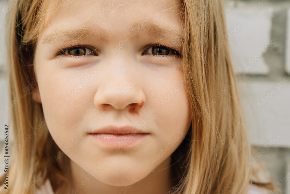 Portrait girl with an abrasion under her eye. child abuse. wounds and abrasions Portrait girl with an abrasion under her eye. child abuse. wounds and abrasions