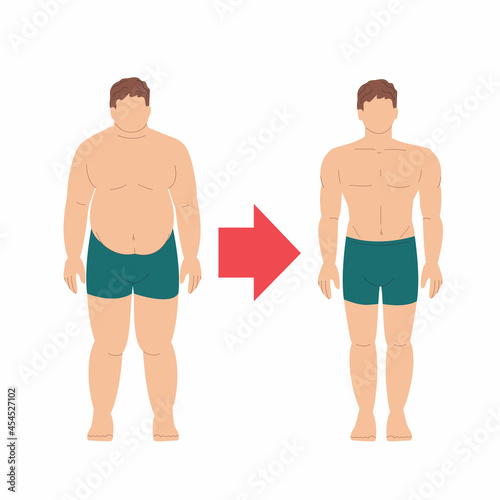 man before and after losing weight. obesity and excess weight. fat and muscle. the person leads a healthy lifestyle. a figure in underpants. patient with diabetes. body positive. stock vector.