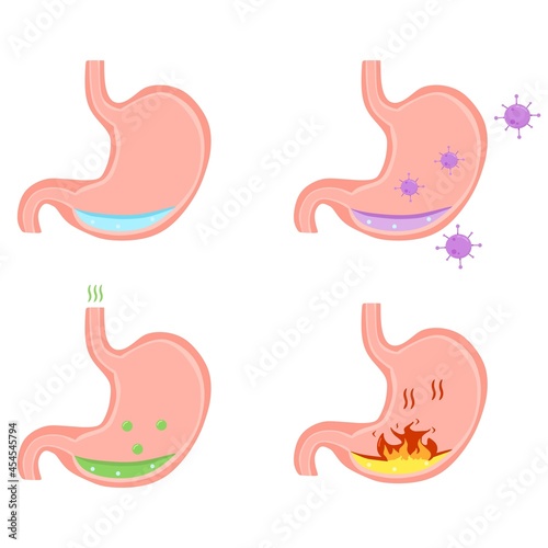 Fototapeta Naklejka Na Ścianę i Meble -  Vector illustration set of a stomach showing infection or illness, perfect for advertising health and education products