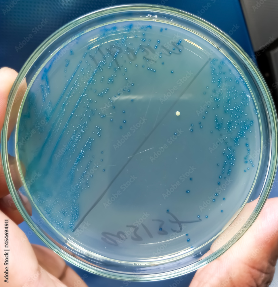 Enterococcus colonies, Gram positive cocci colonies as test on UTI Agar