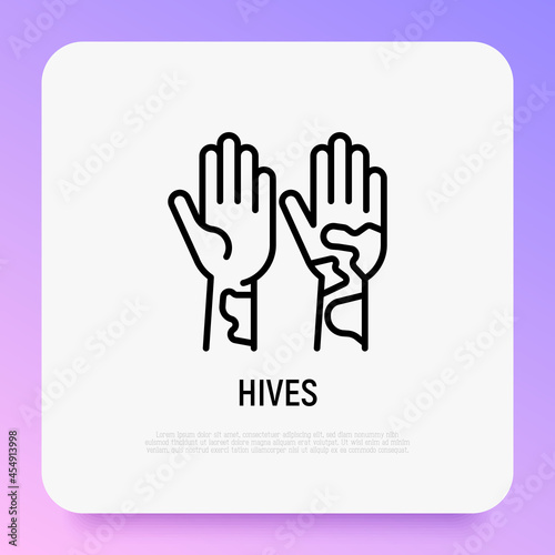 Hives on hand thin line icon. Allergy symptom. Modern vector illustration of allergic reaction.