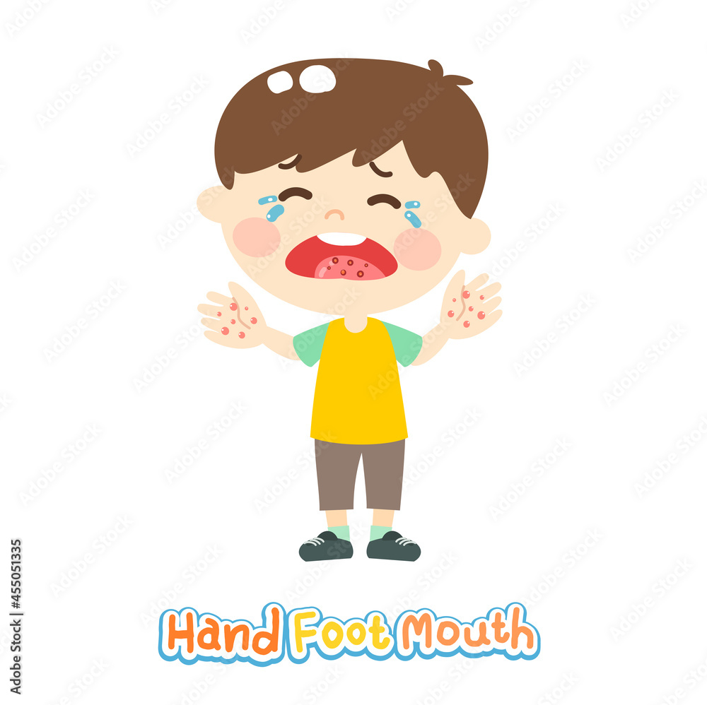 Hand Foot and Mouth Disease 	