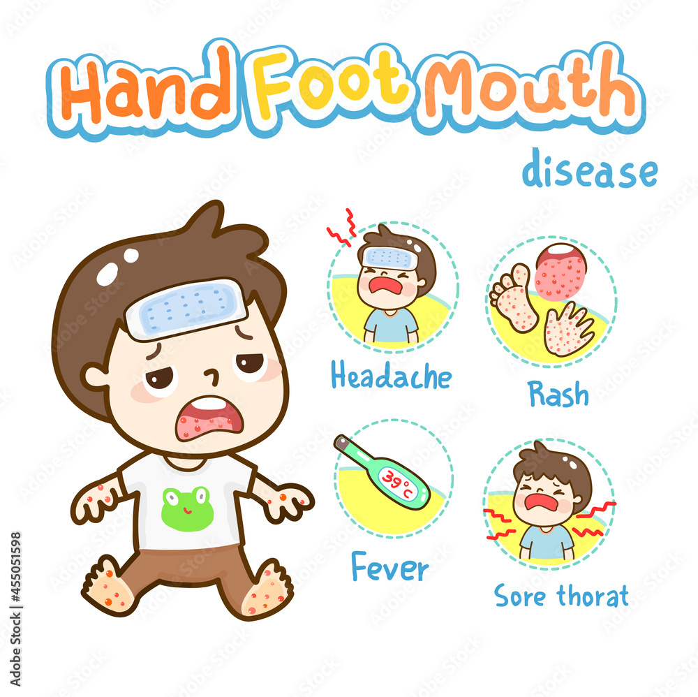 Hand Foot And Mouth Disease Stock Vector Adobe Stock Hand Foot And Mouth Disease Stock Vector Adobe Stock