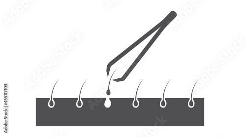 Illustration of tweezers and hair on the skin. Vector isolated editable flat illustration
