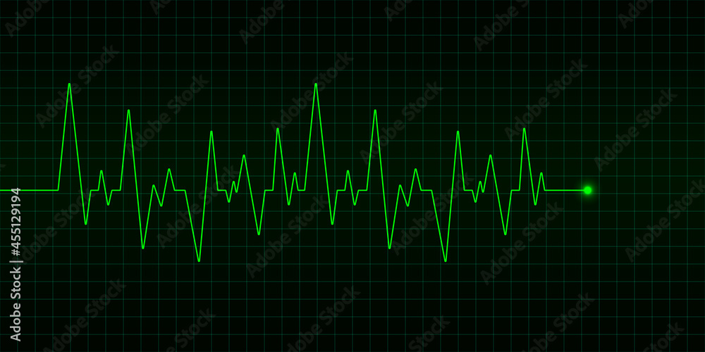 Cardiogram on green background. Heartbeat pulse. Cardio symbol. Vector illustration.