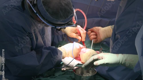 surgeons use cell salvage during open heart surgery