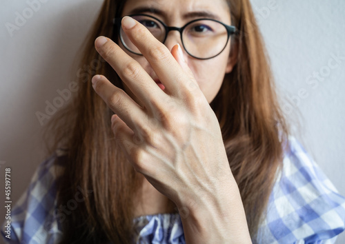 Canvas Print Close up of Asian woman showing her bulging hand veins