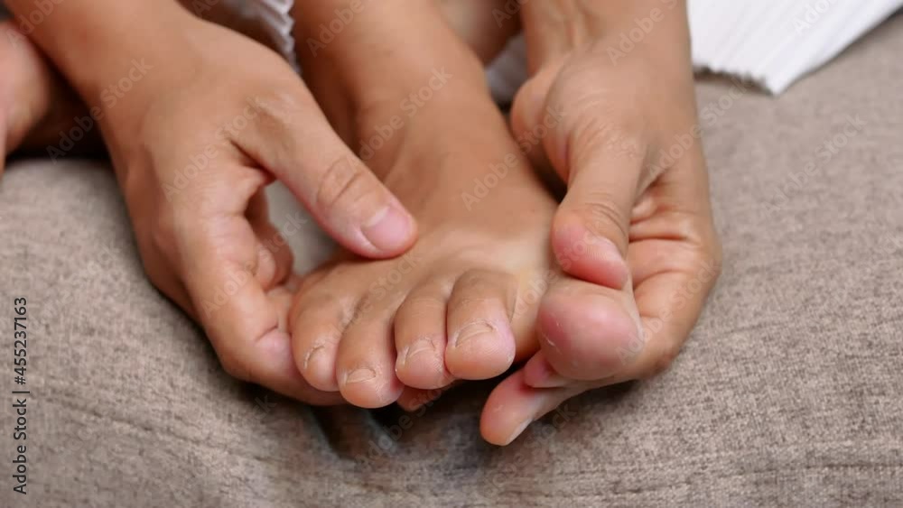 Closeup of female holding her painful feet and massaging her bunion toes to relieve pain. Swollen bunion at the edge of the big toe causes deformity (Hallux valgus). Woman's health concept. Closeup of female holding her painful feet and massaging her bunion toes to relieve pain. Swollen bunion at the edge of the big toe causes deformity (Hallux valgus). Woman's health concept.